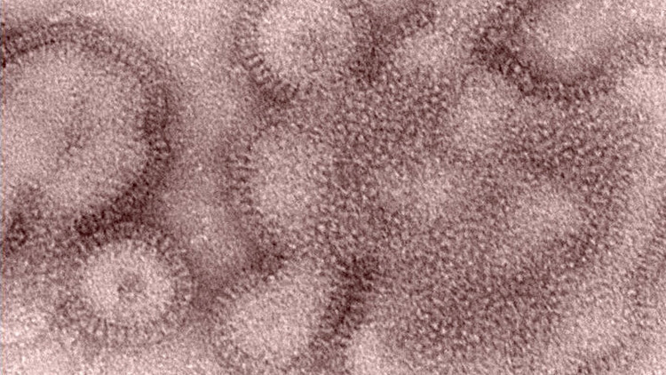 abdde-h3n2-virusu-endisesi-farkli-ulkelerde-de-goruldu-salgin-siddetli-olabilir-qDwfsA26.jpg