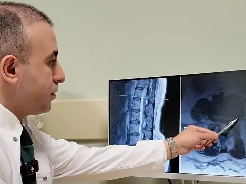 Bel Fıtığı Hakkında Bilinmesi Gerekenler: Ameliyat Son Çare Olmalı